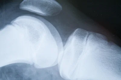 xray.jpg