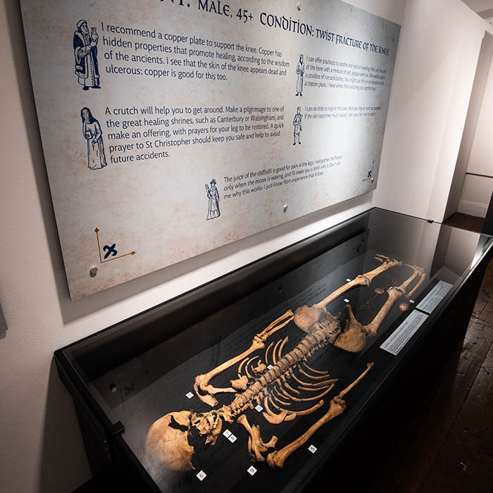 Medieval Medicine - Skeleton Display