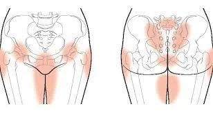 Do you have Pelvic Instability? Pain in your pelvis during pregnancy? You may have PRPGP!