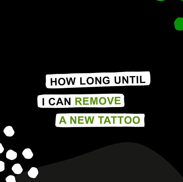 Affordable Small & Large Tatto Removal Adelaide | Tattoo Removal Adelaide Cost & prices Affordable Small & Large Tatto Removal Adelaide | Tattoo Removal Adelaide Cost & prices