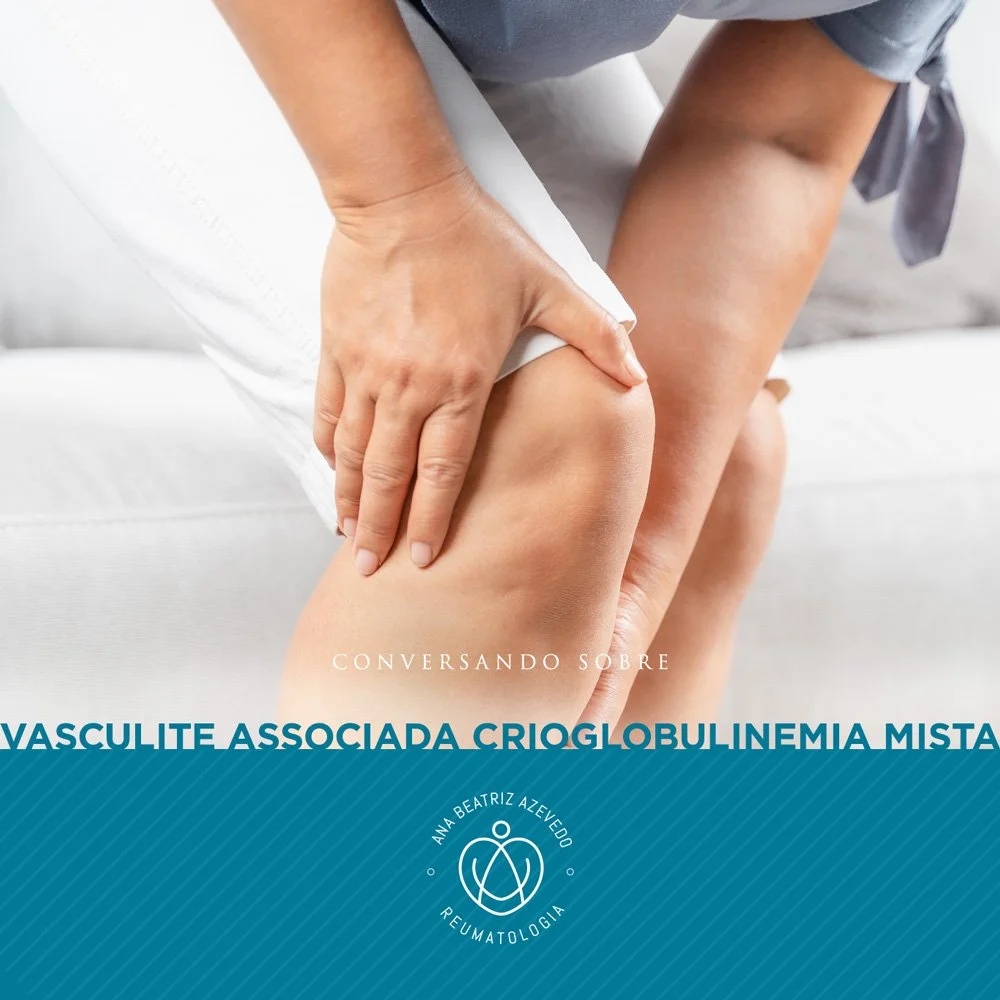 CONVERSANDO SOBRE VASCULITE ASSOCIADA CRIOGLOBULINEMIA MISTA