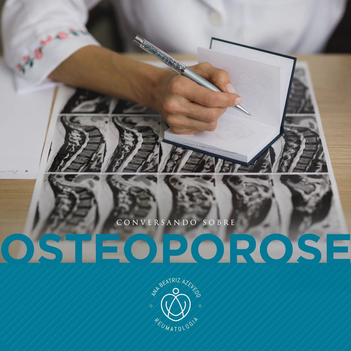 CONVERSANDO SOBRE A OSTEOPOROSE