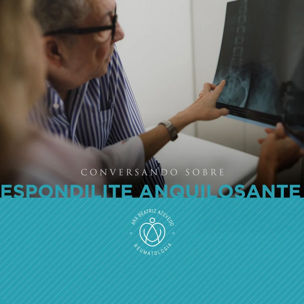 CONVERSANDO SOBRE ESPONDILITE ANQUILOSANTE 