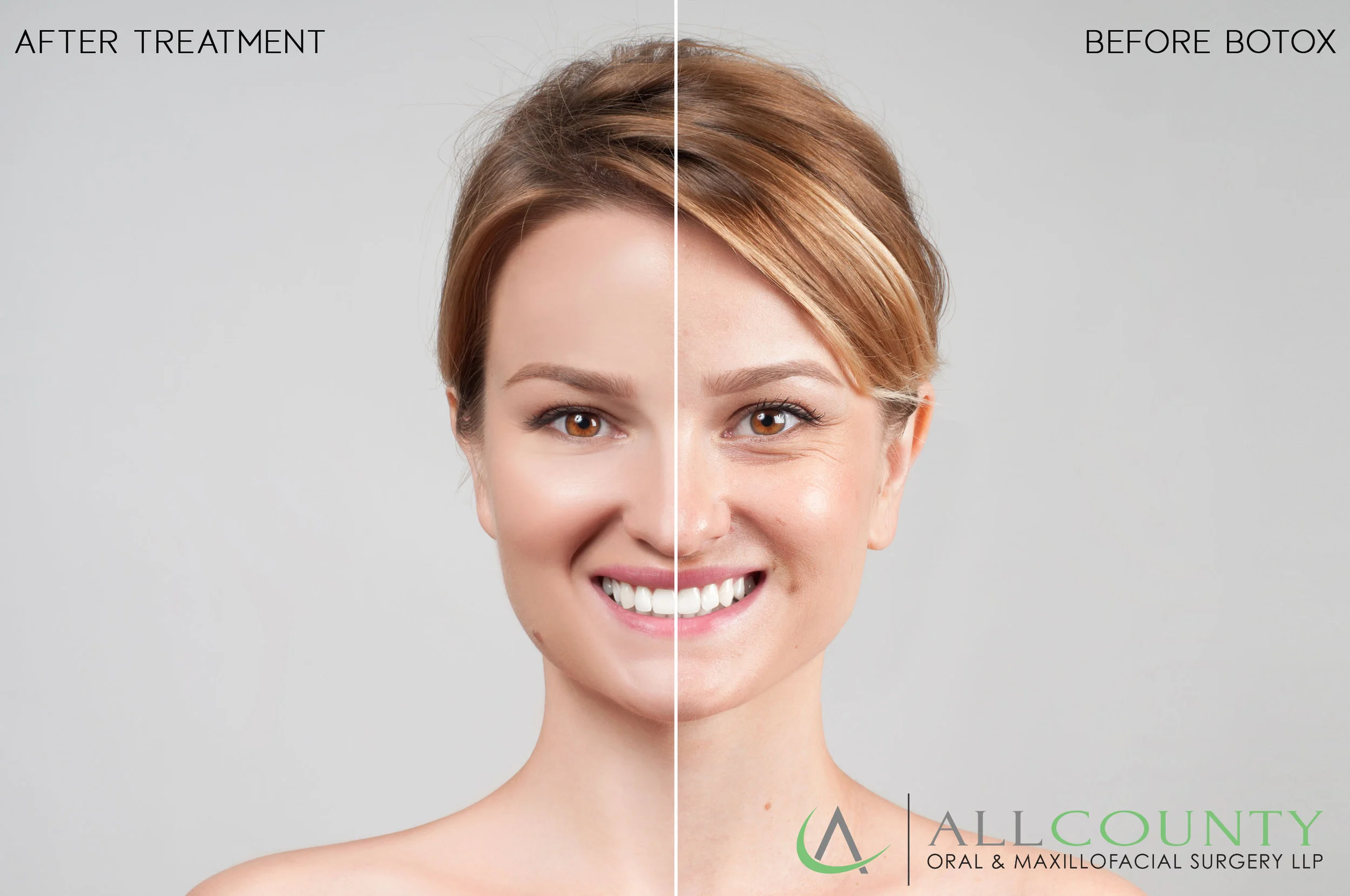 beforeandafter.jpg