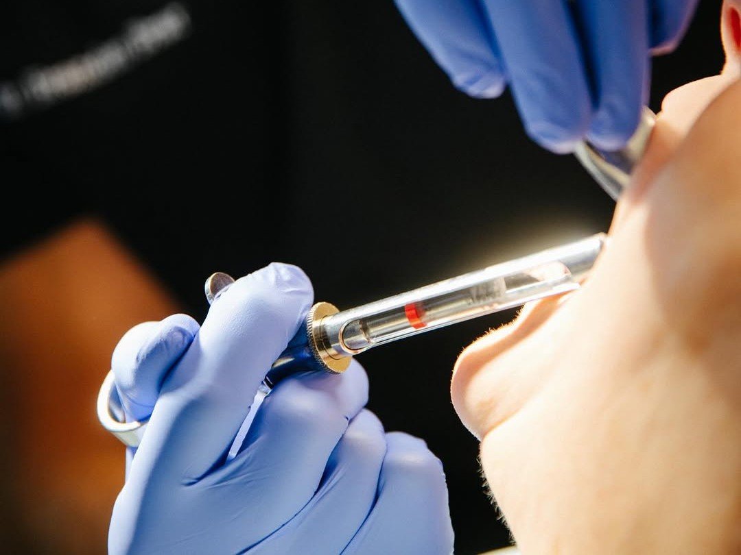Our oral surgeons in New York and Long Island use dental anesthesia to keep patients comfortable during Procedures.