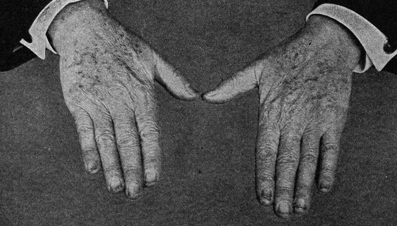This Photo of Thomas Edison's Hands Was Clickbait in 1919
