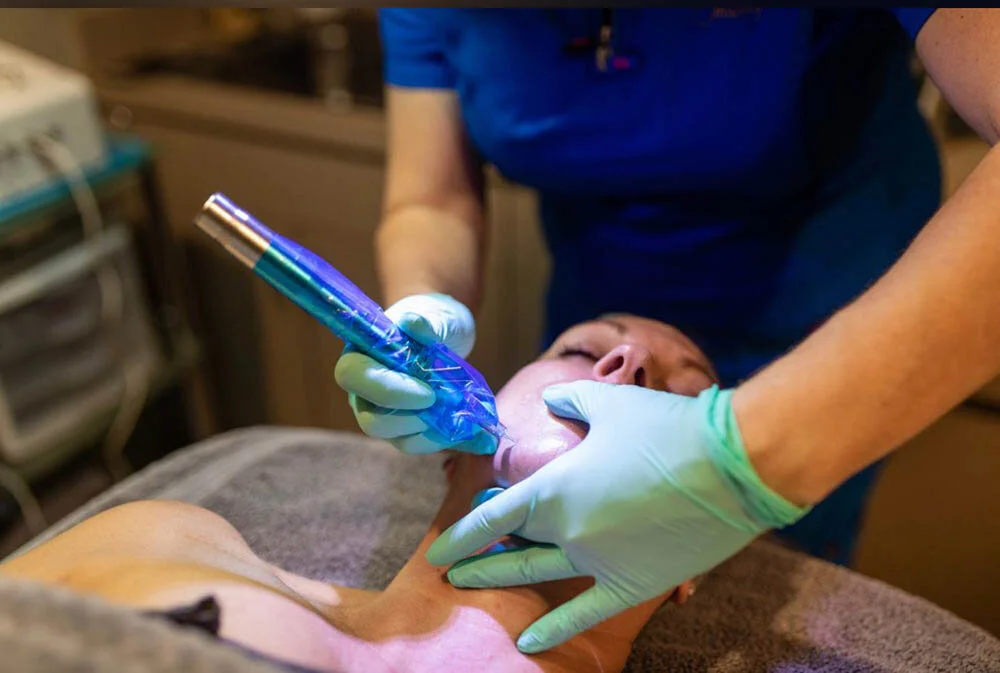 Sharpen Your Knowledge About Microneedling