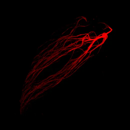 research_image_Example Glomerulus_M71.jpg