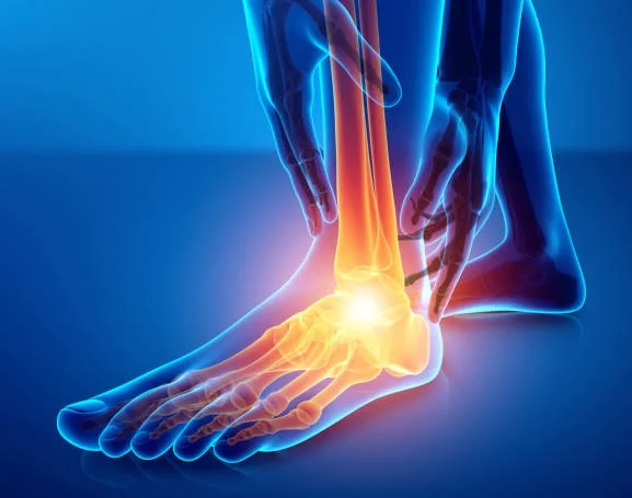 3d Illustration of Male foot with ankle pain