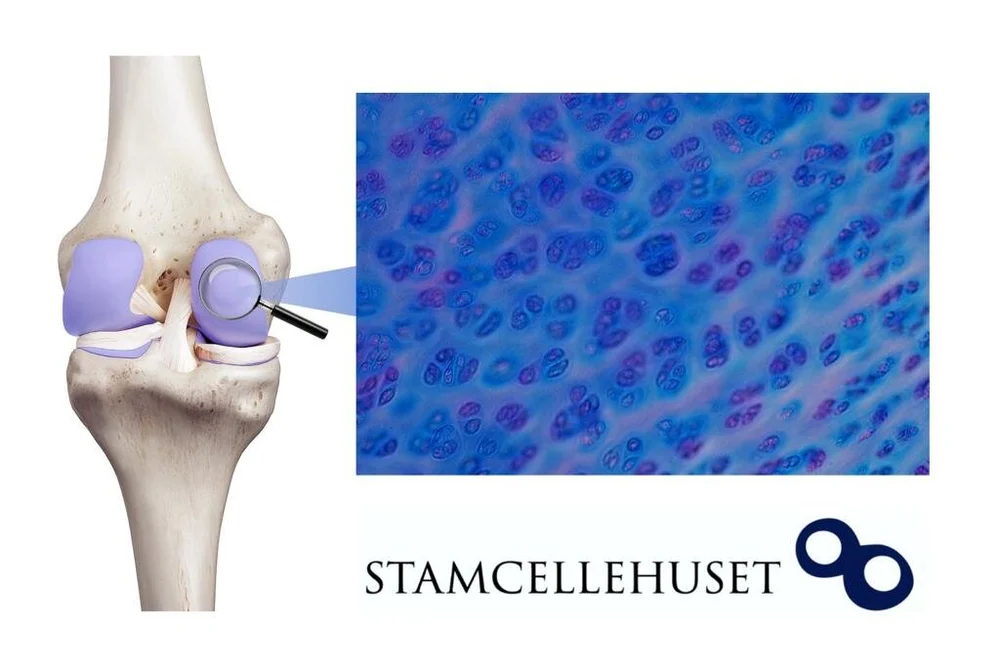 Menisk Skade Football Clipart