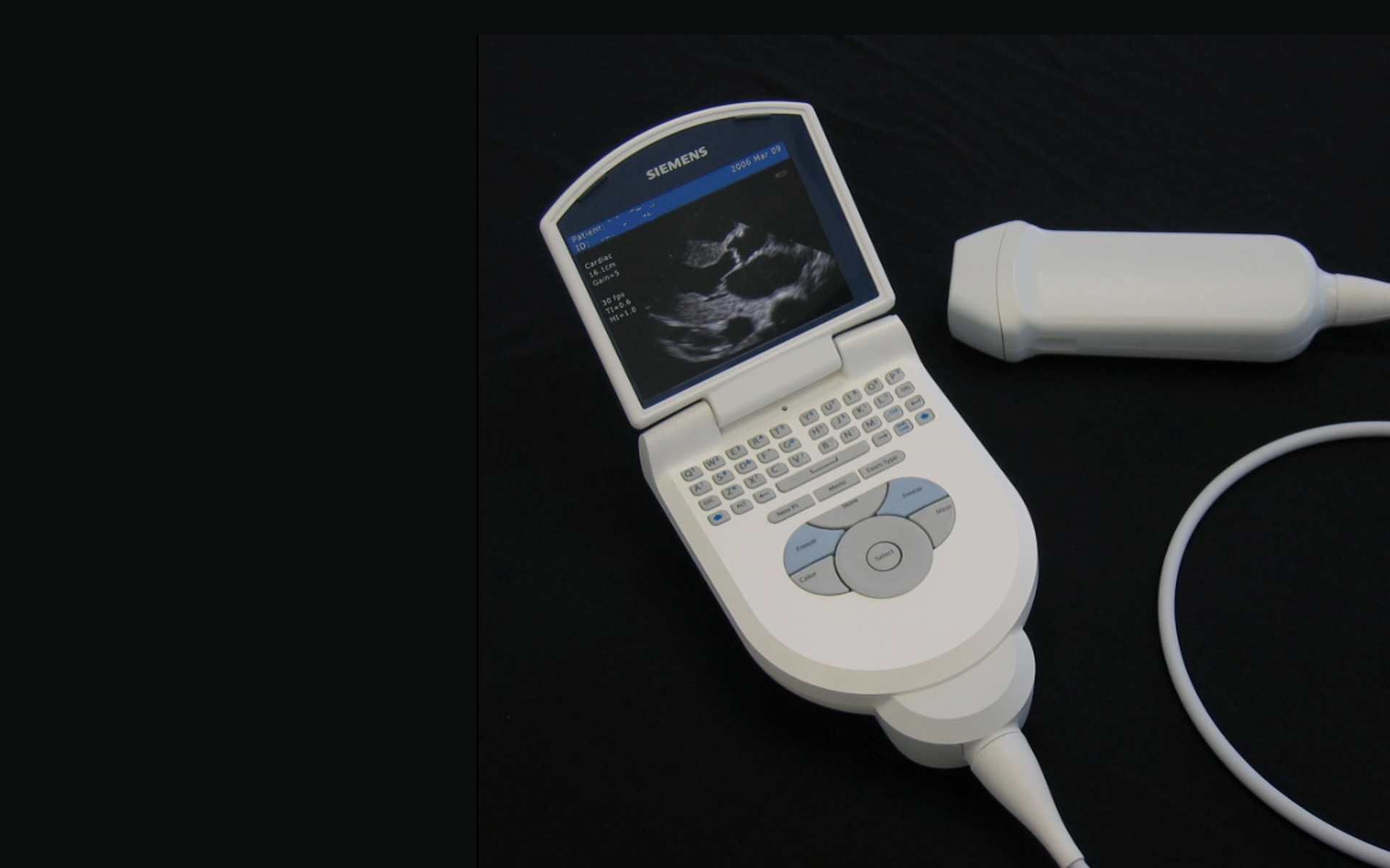siemens-acuson-p-10-ultrasound.jpg