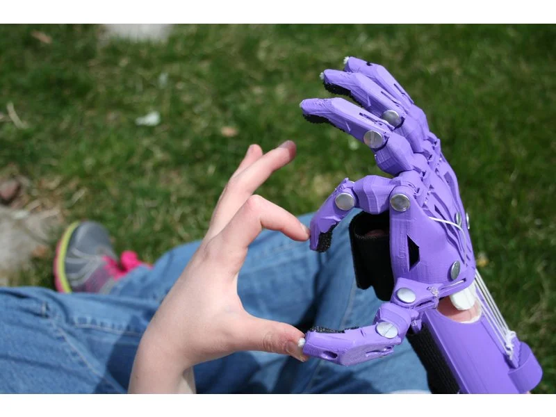 eNABLE is a global network of volunteers that builds prosthetic devices for those with upper limb differences.