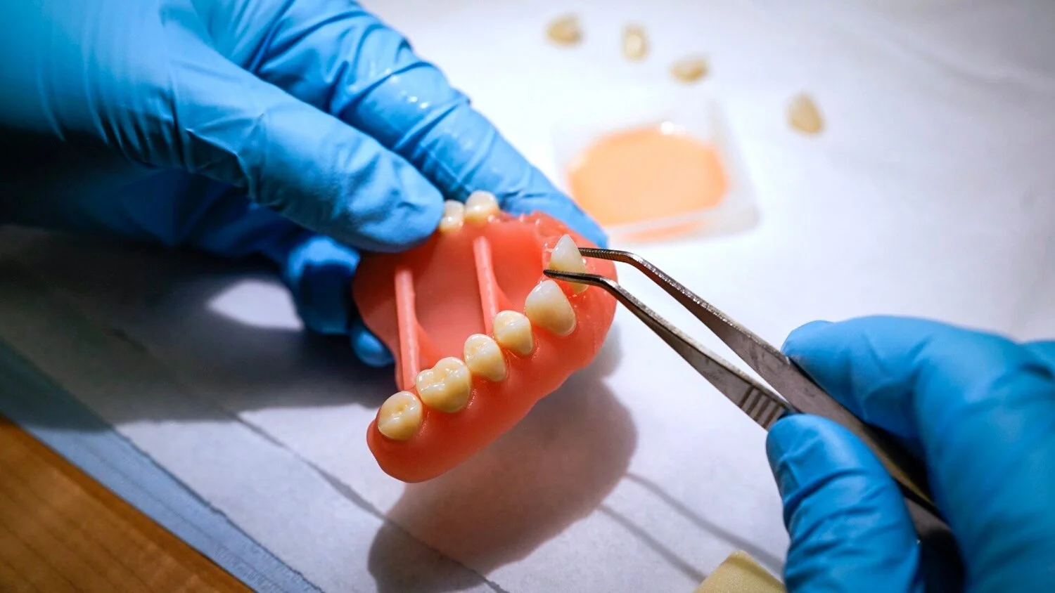 Digital Dentures/Carbon®