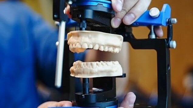 Stoneless Mounting Model/Evident