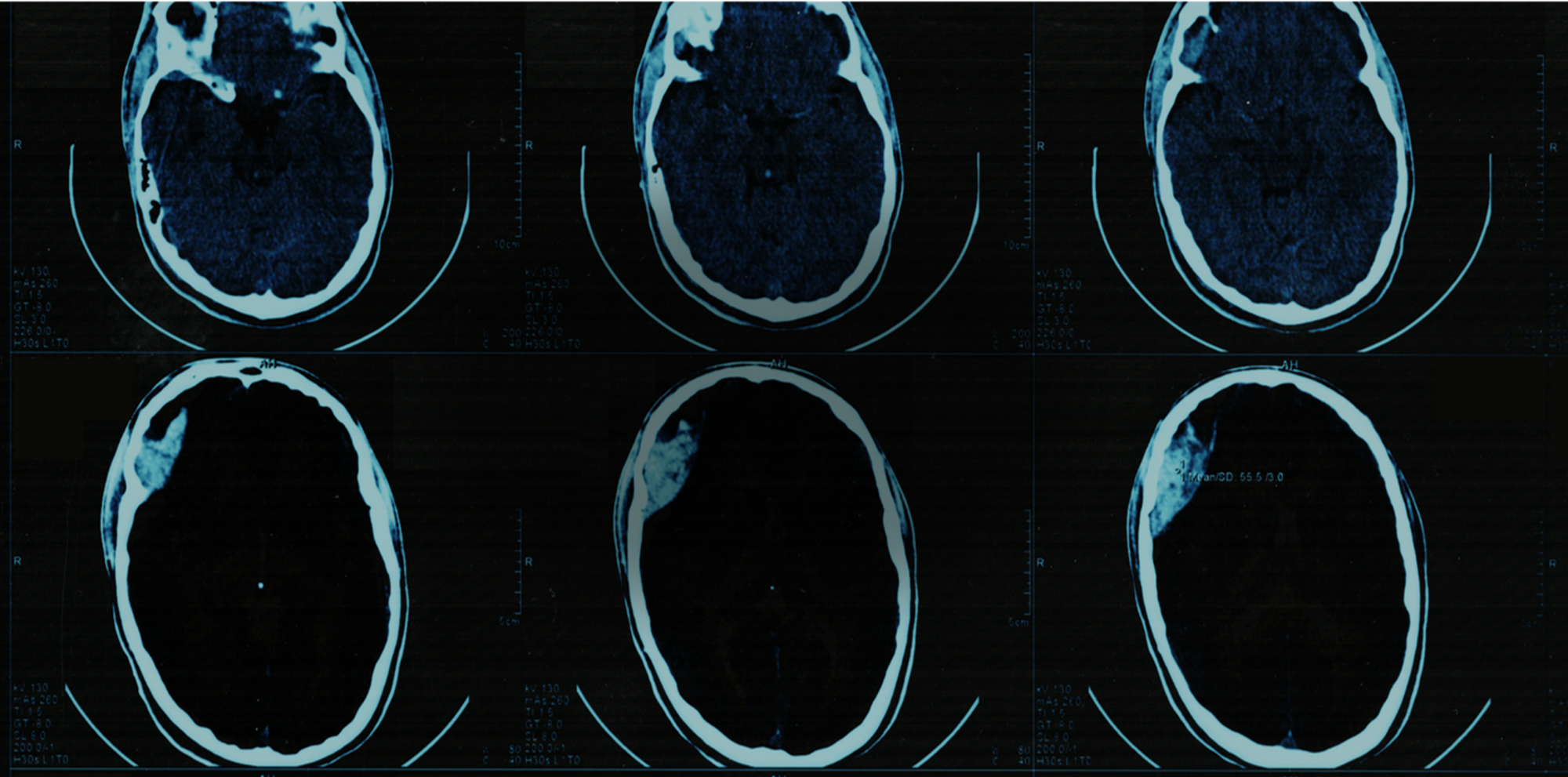 SkullScan10.png