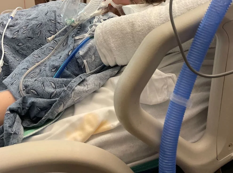 Teenager addicted to vaping on life support ‘toxic’ e-cigarette chemical damages lungs