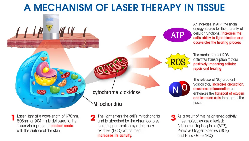 class iv laser therapy near me