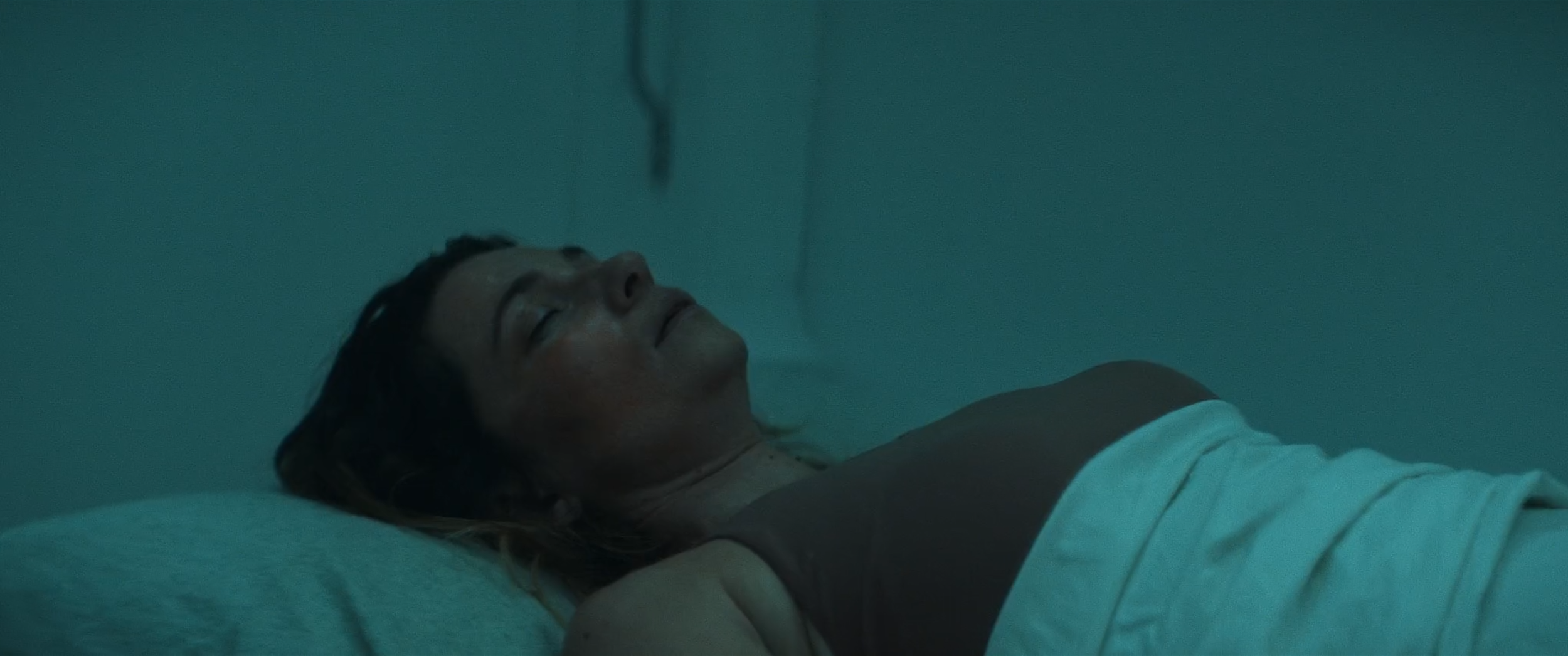 A woman lying in a hospital bed with her eyes closed, appearing to be resting or asleep.