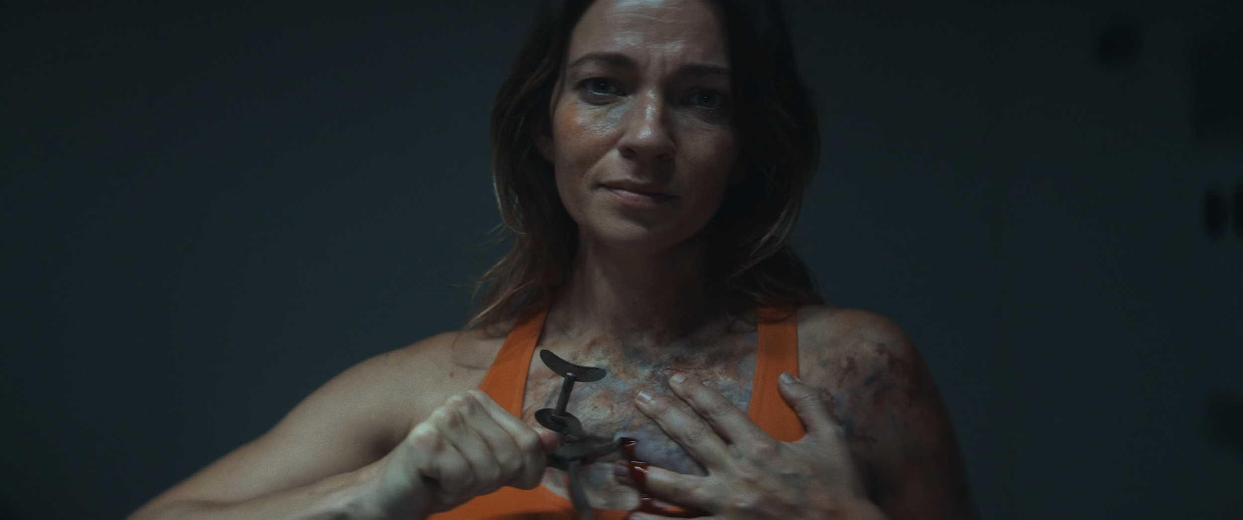 A woman wearing an orange tank top is using scissors to cut a tattoo, revealing her skin covered in burns, scars, and other injuries.