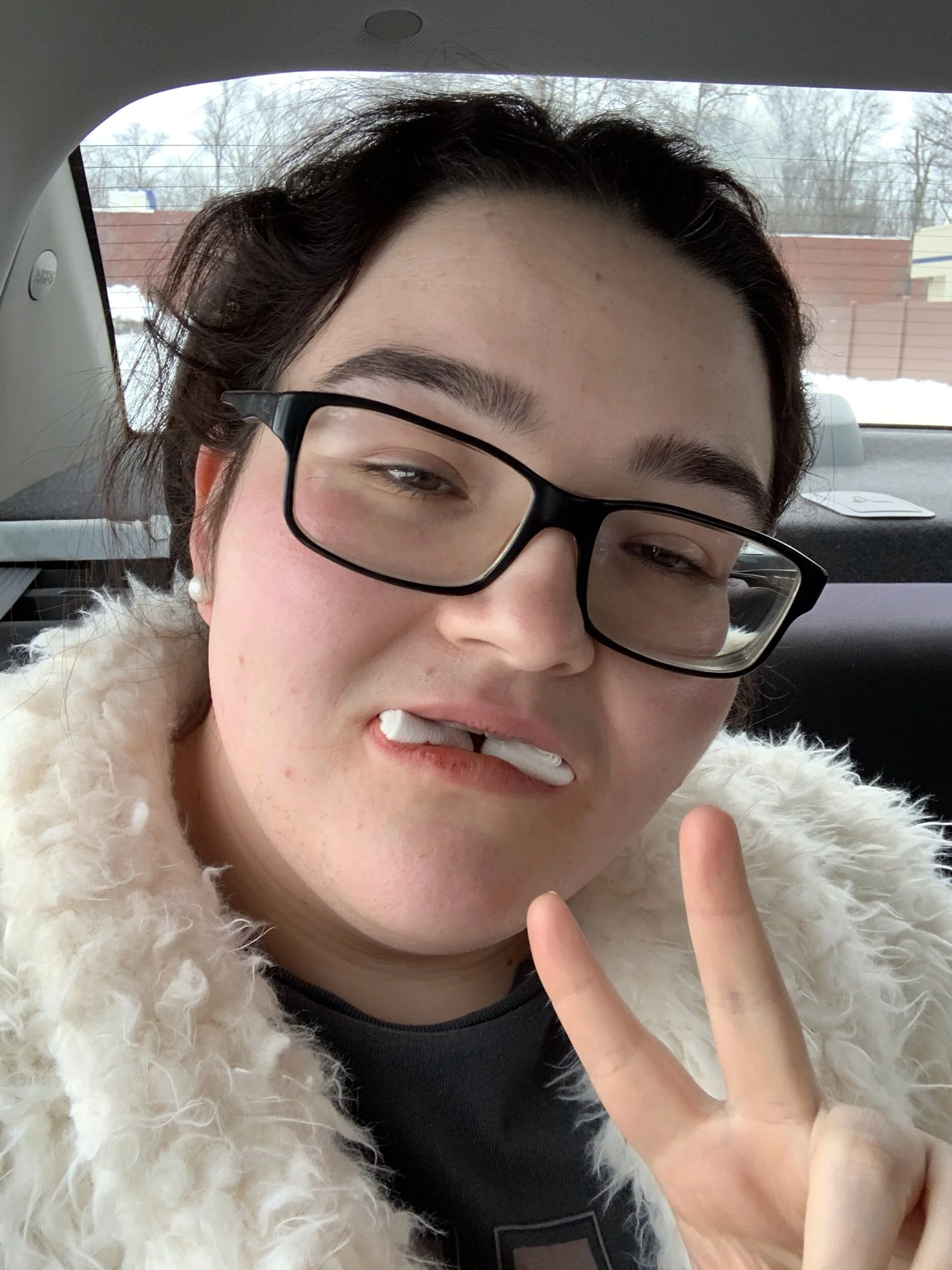 Getting My Wisdom Teeth Removed 