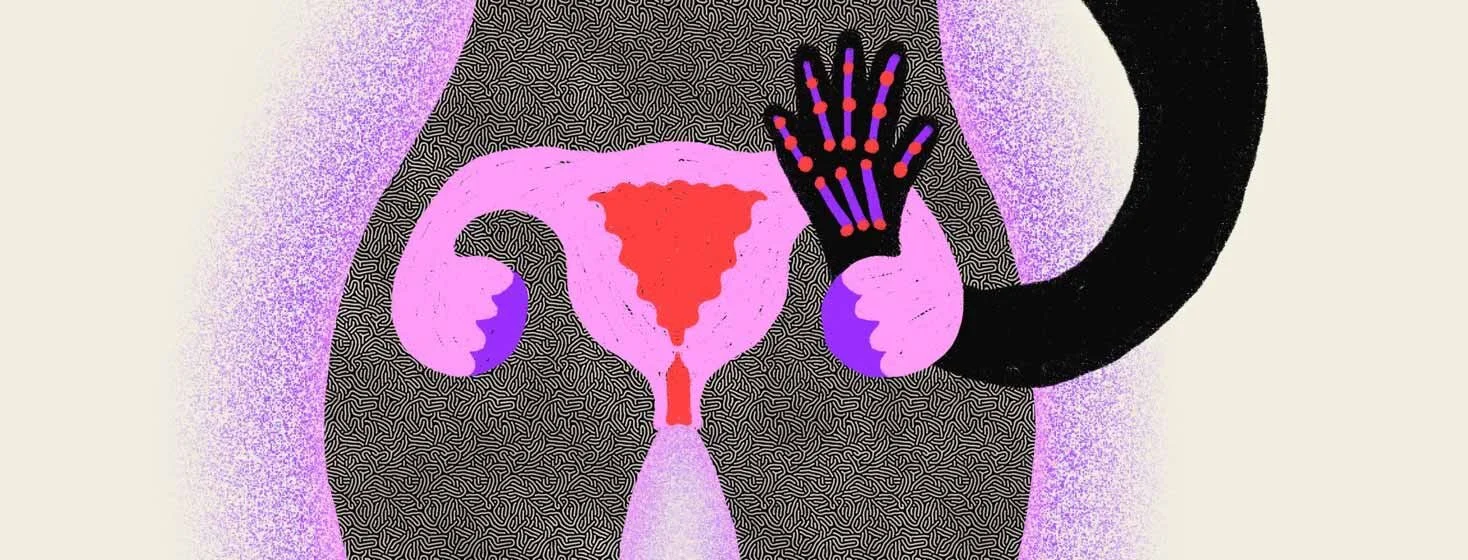 RA-living-menopause.jpg