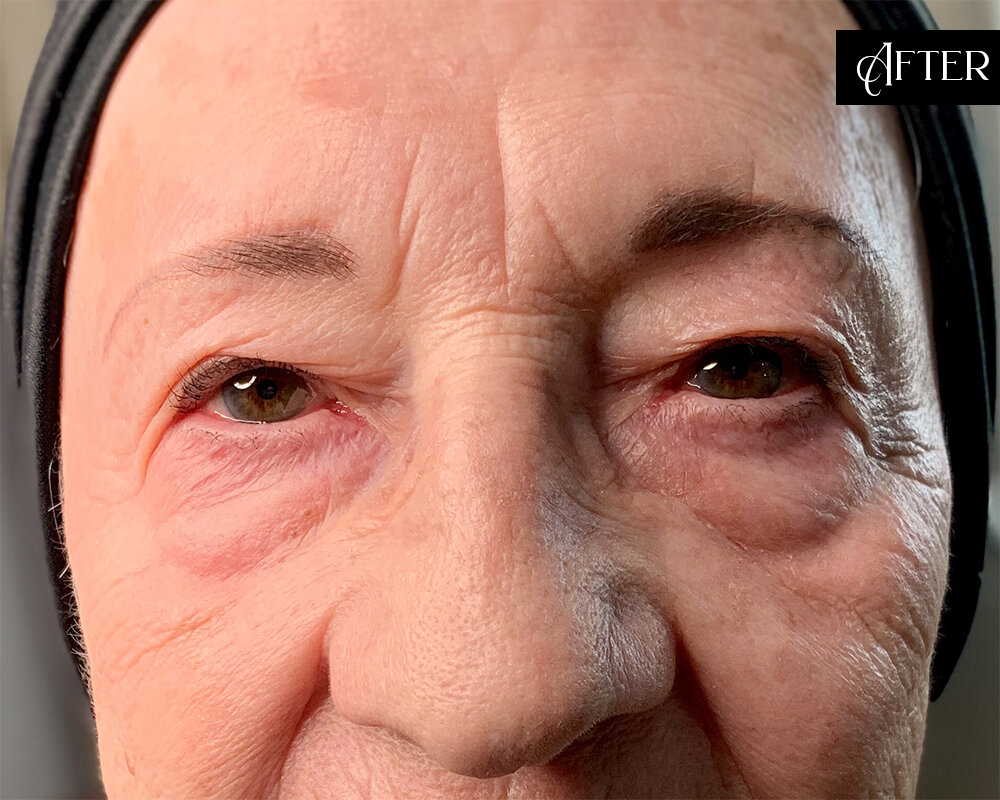 Skin Craft Beauty - Skin Tightening
