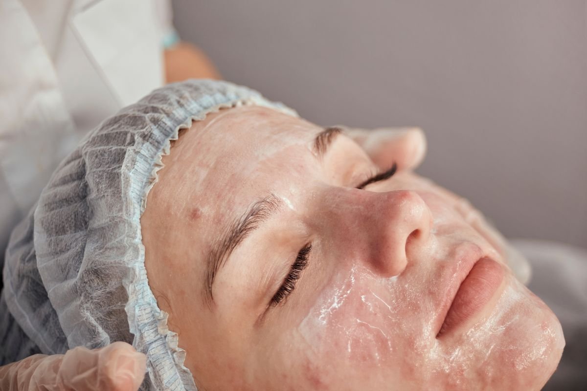 Acne Treatment in Sheboygan: What to Expect from Your First Session