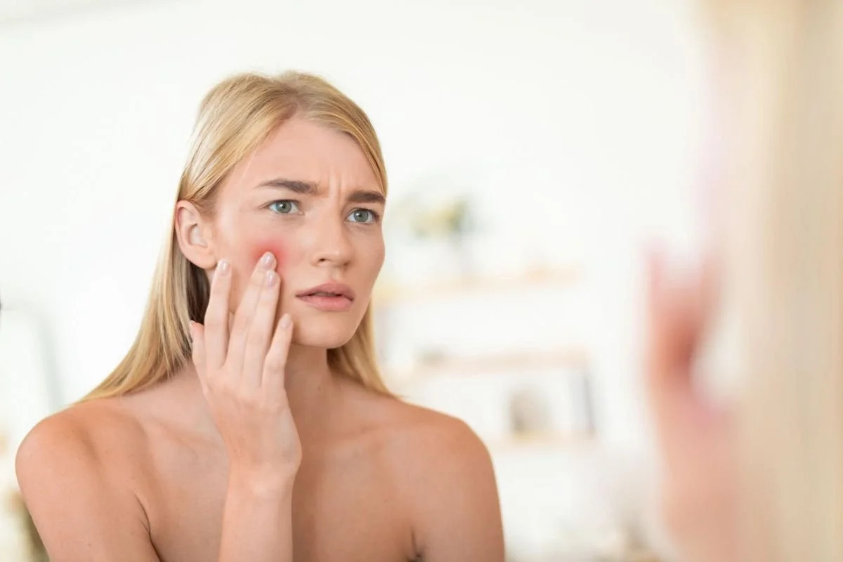 who benefits from acne facial different skin types Sheboygan skincare