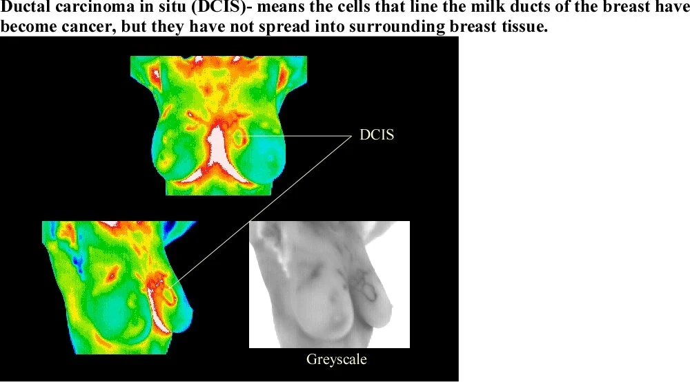 Thermography — Gratitude for Wellness