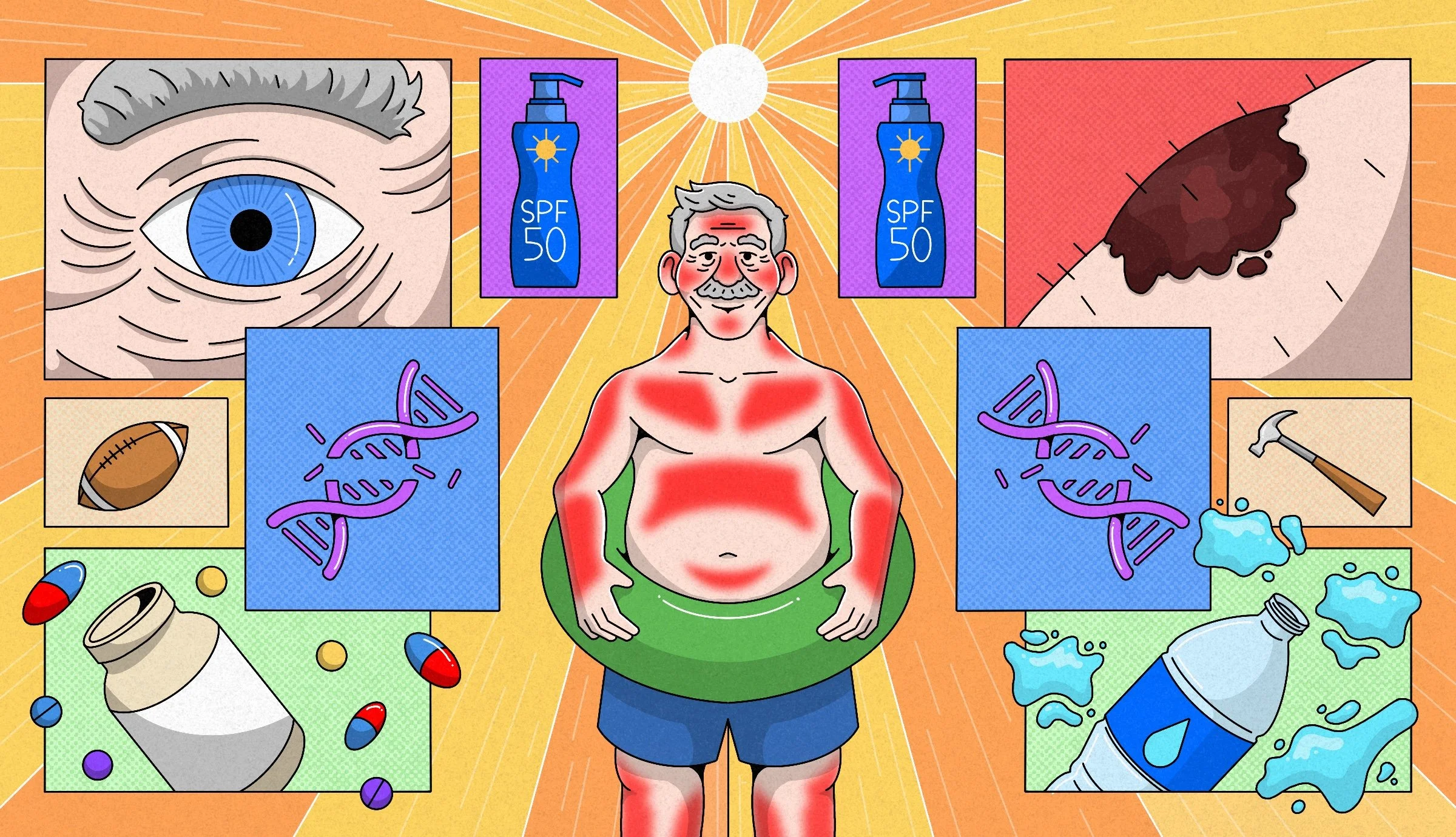 sunburn.jpg