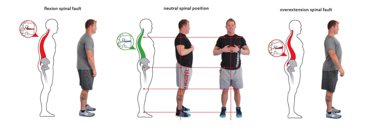 Figure 1: Neutral spinal position in relation to common spinal faults. (Starrett, Kelly. Becoming a Supple Leopard. (2015) Pages 56,58,59)