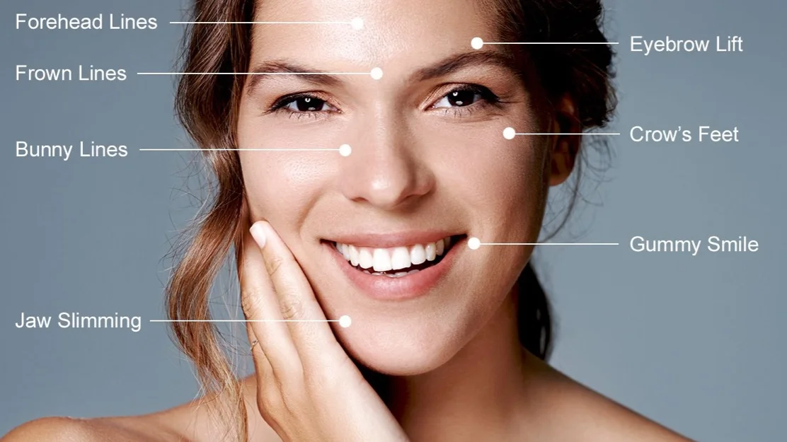  Did you know Neuromodulators like Botox/Xeomin can help correct and prevent lines in all these areas? 