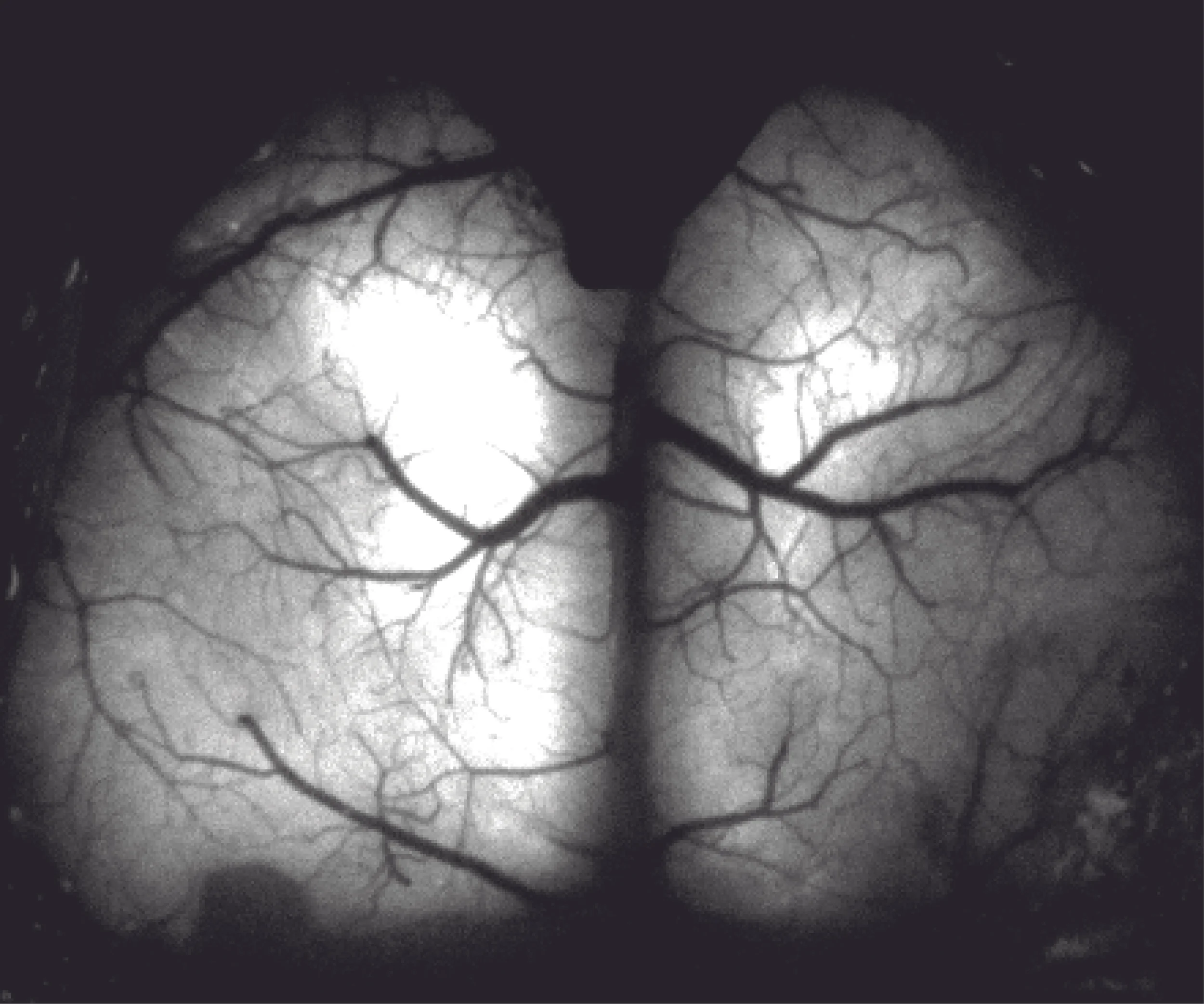 Whole cortex image of a Thy1-YFP mouse implanted with a See-Shell