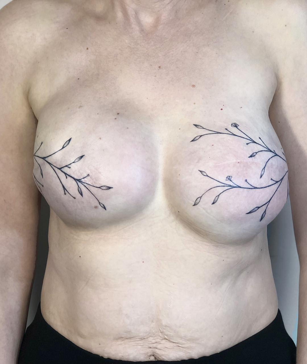 reclaiming chloe's breasts
