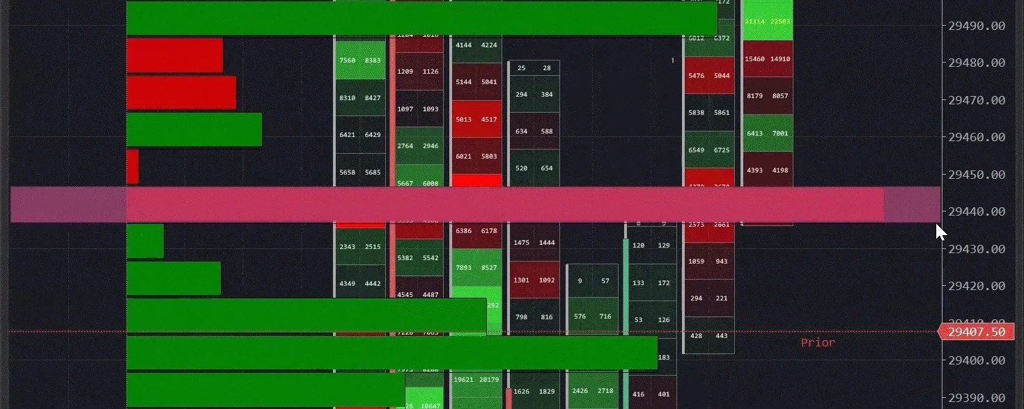 Your charts can't tell you who's in pain