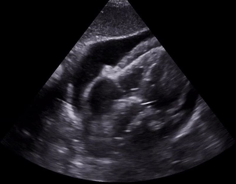 Everyday Ultrasound
