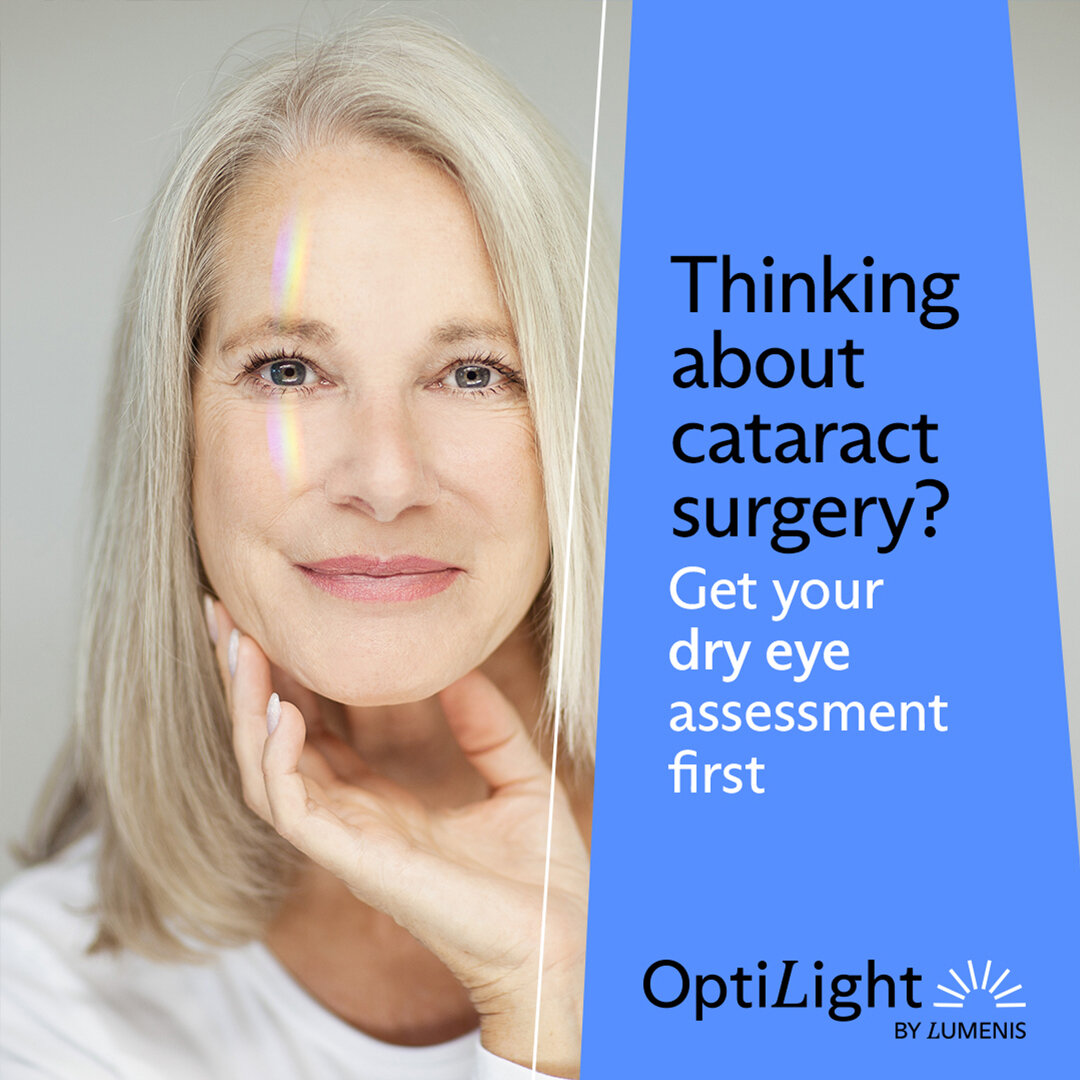 Are you aware of the impact dry eye disease can have on the success of your cataract surgery? If you have undiagnosed dry eye beforehand, you're more likely to develop refractive errors after cataract surgery. With OptiLight by Lumenis&reg;, you can 