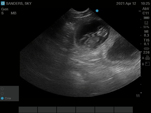 Sky ultrasound 