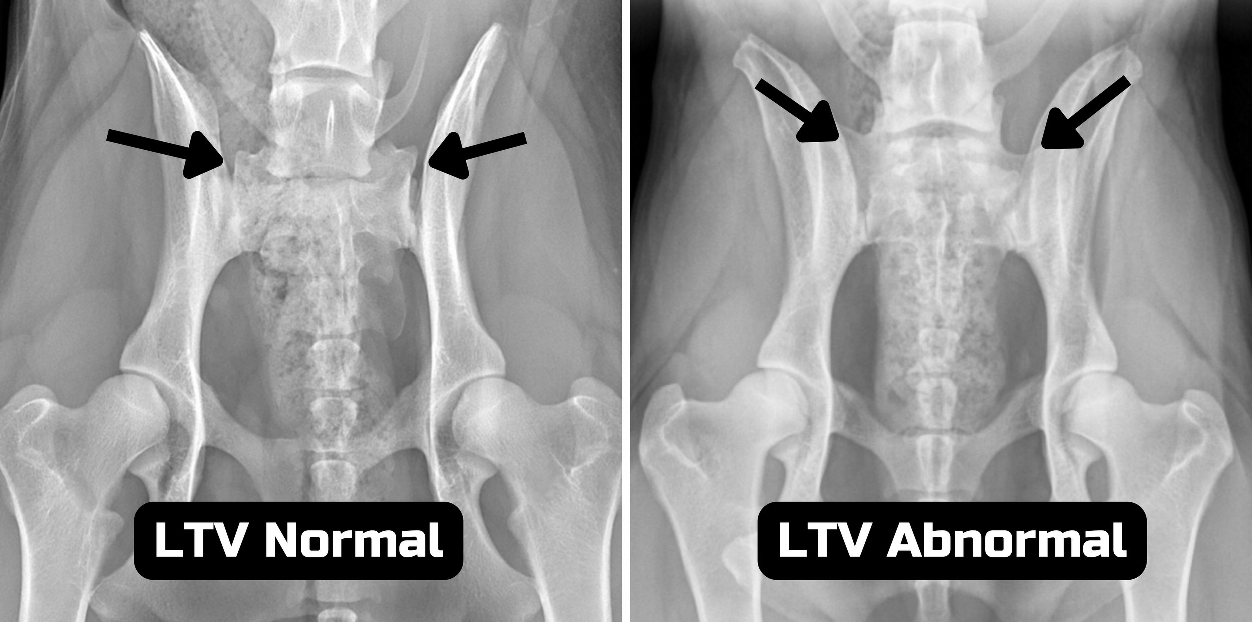 LTV normal and abnormal