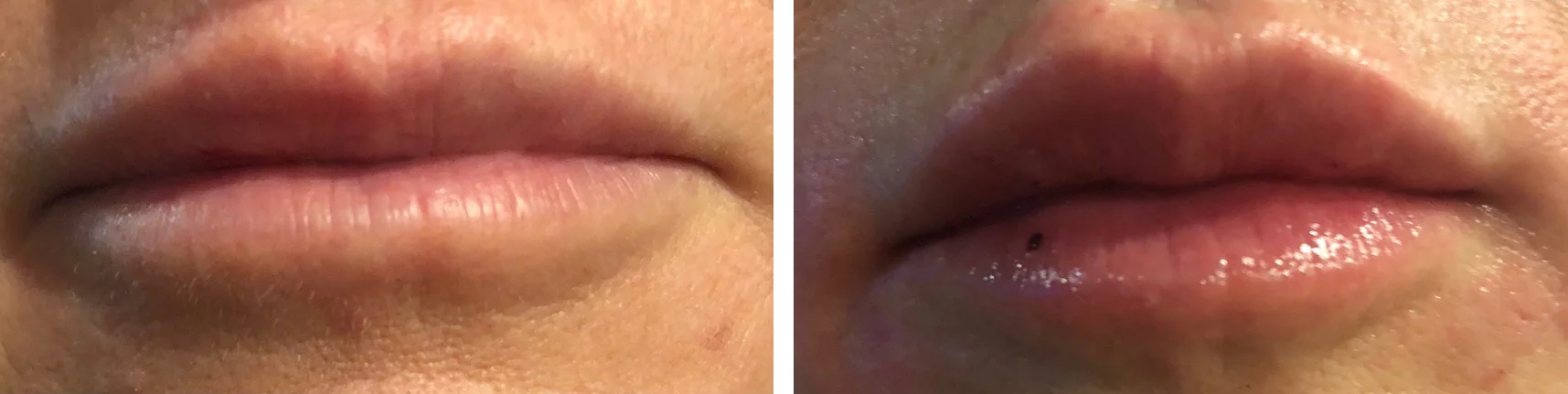 lip2.jpg