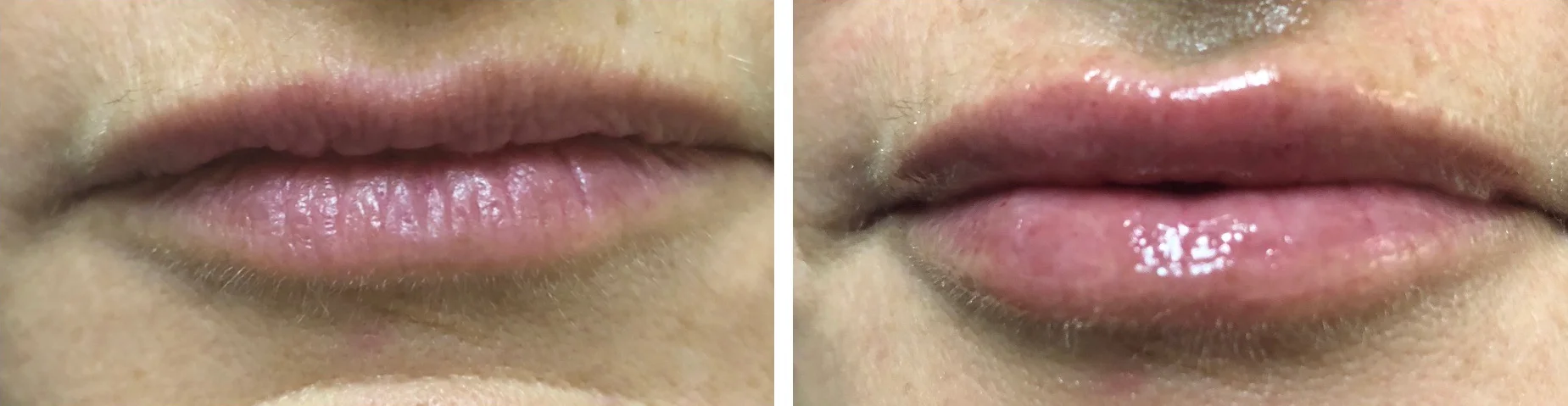 lip3.jpg