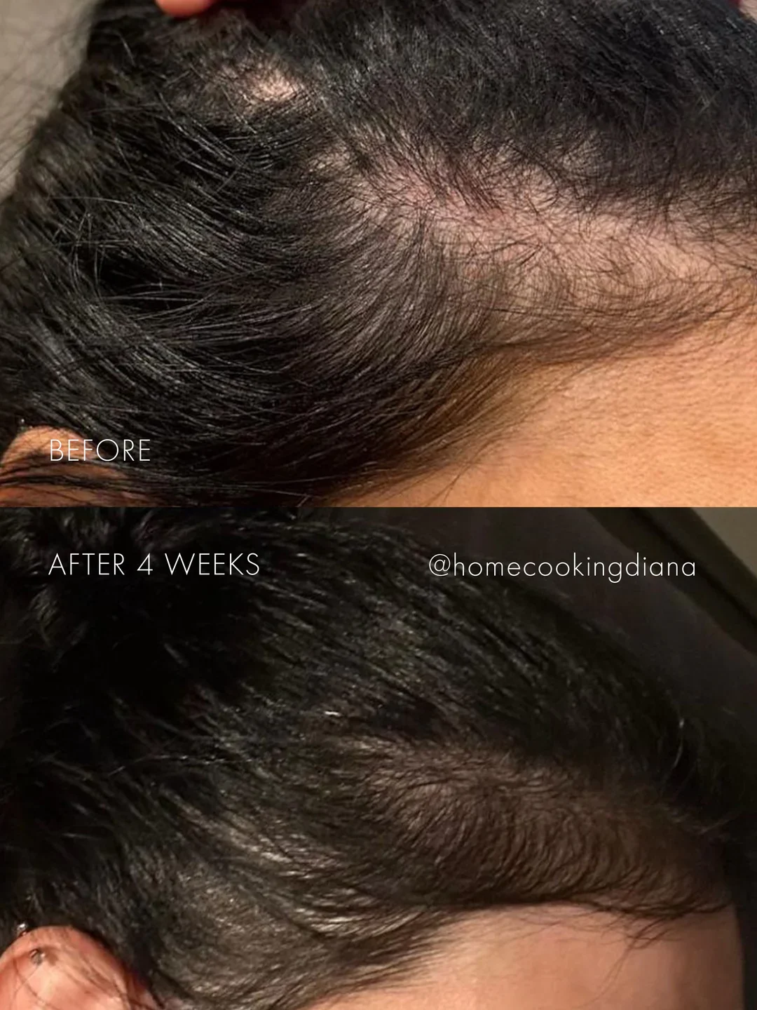 293_The_Hair_Serum_before_after_1080x.jpg.webp