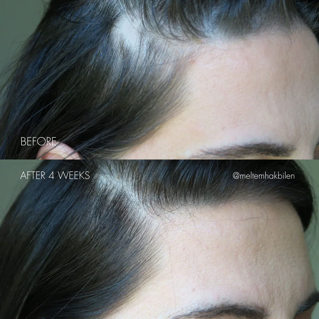 293_The_Hair_Serum_before_after_01_1080x.png.webp