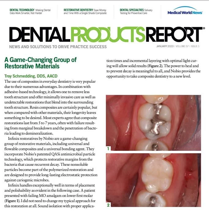 A Game-Changing Group of Restorative Materials