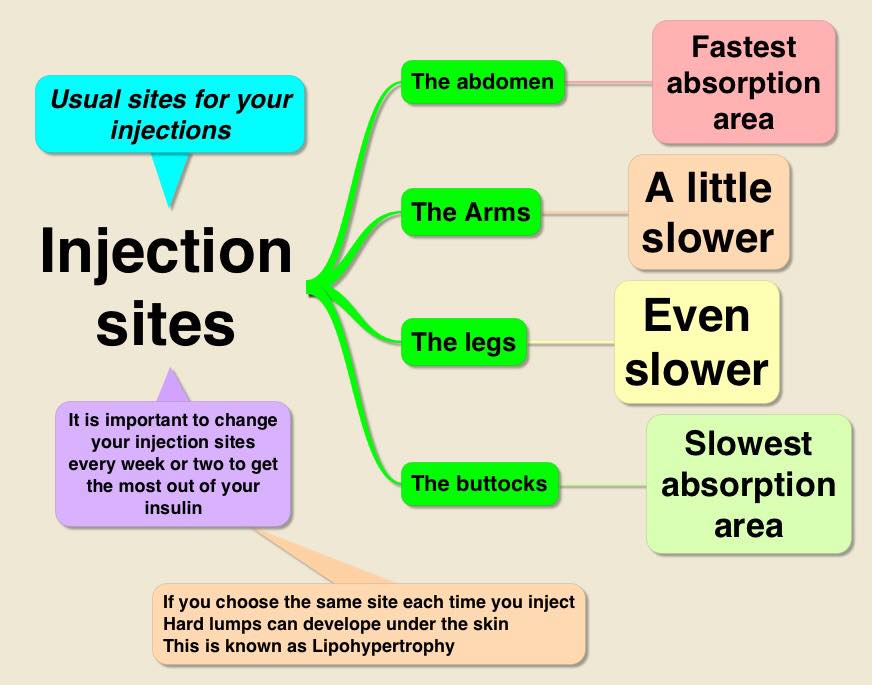Facebook Image on Where to Place Injection Sites.jpg
