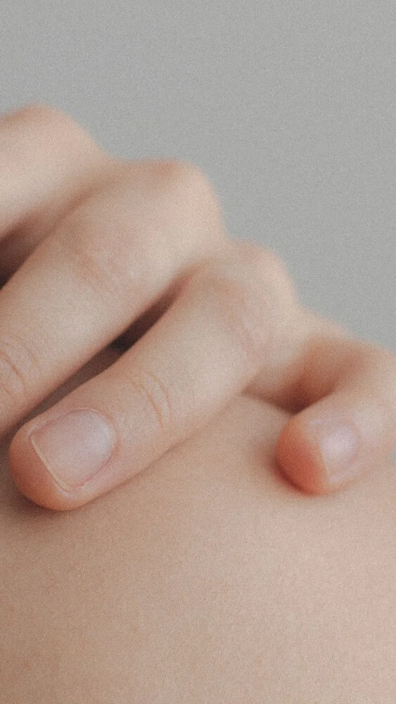 Skin Sensitivity Explained - Rosacea, Eczema, Psoriasis