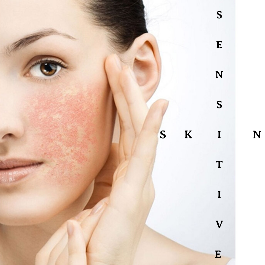 Settling Down Sensitive Skin