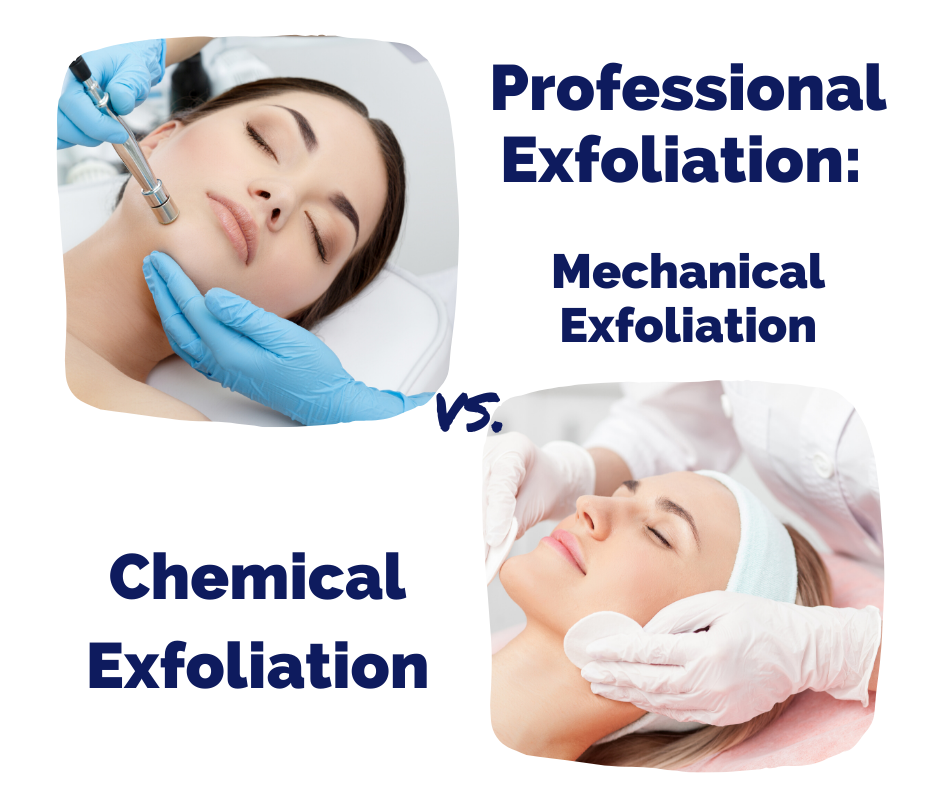 TIOT: Exfoliation