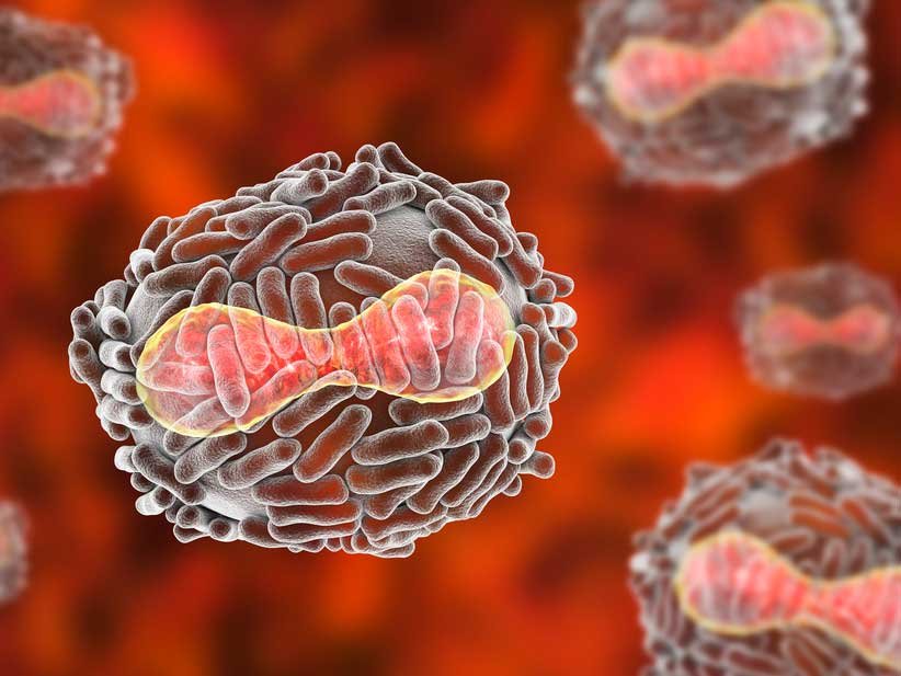 La Minuta AM: Tras el primer caso sospechoso en Argentina, te contamos todo lo que necesitas saber sobre la Viruela del Mono