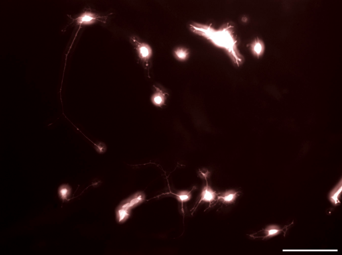 7div 5dpTF  7+25  20x+10x.png